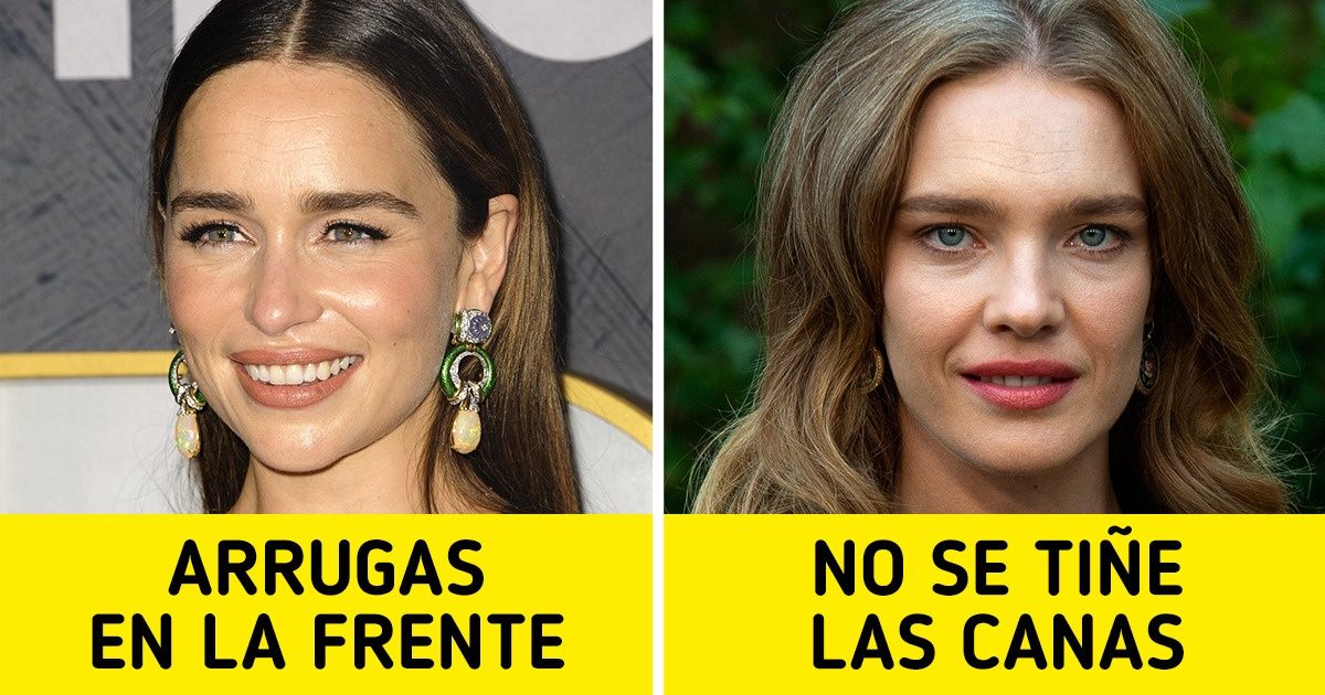 14 Mujeres famosas que no borran las marcas de la edad, sino que las convierten en su nuevo detalle distintivo 14 Mujeres famosas que no borran las marcas de la edad, sino que las convierten en su nuevo detalle distintivo