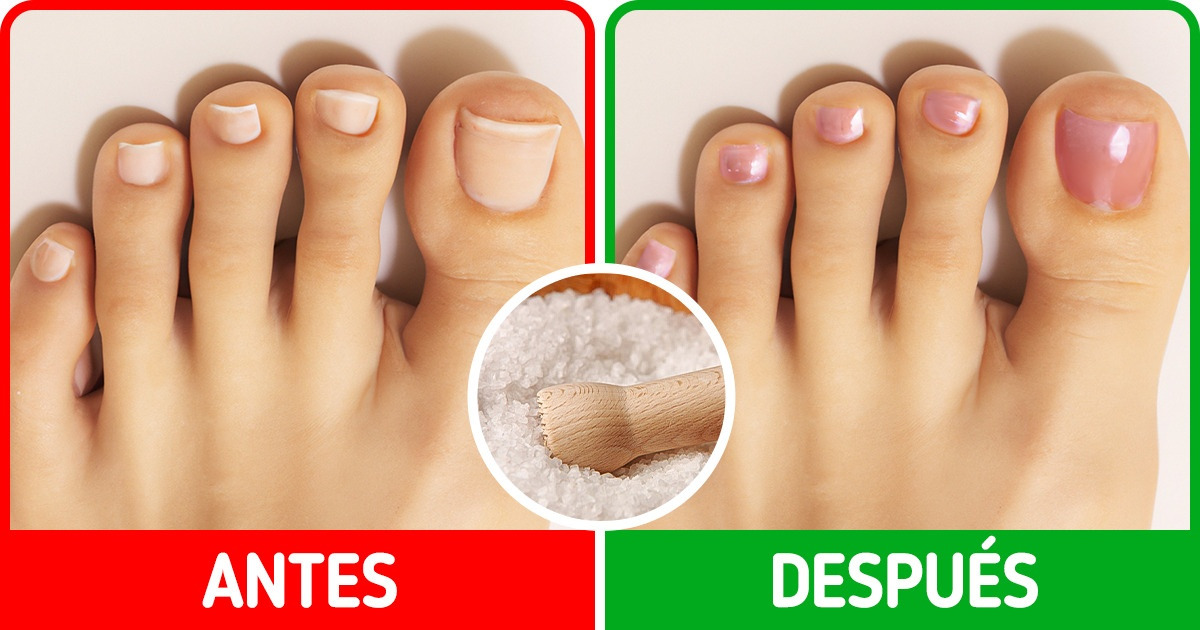 Presume una pedicura perfecta gracias a las sales de Epsom Presume una pedicura perfecta gracias a las sales de Epsom
