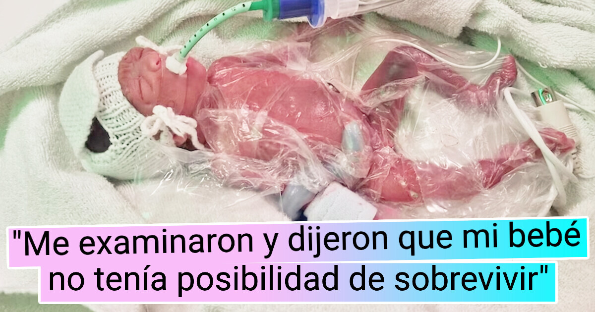Así luce la bebé que nació a los 5 meses de embarazo pesando medio kilo