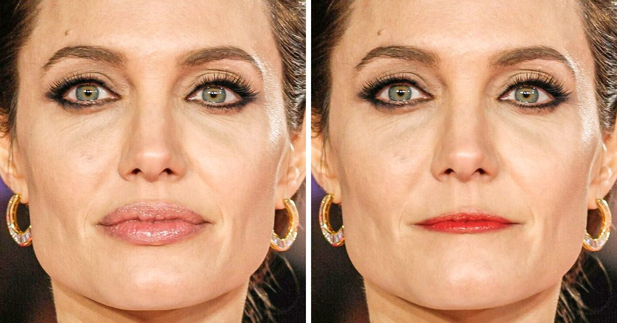 17 Fotos que demuestran que un retoque en los labios puede cambiar el rostro completamente