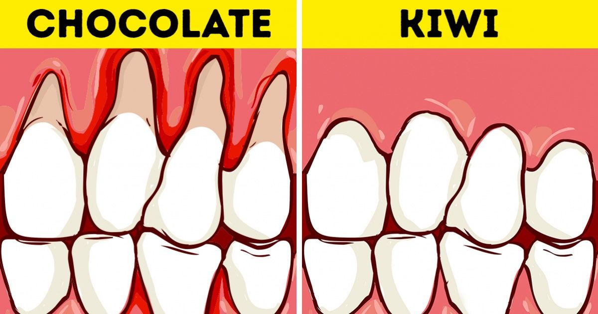 Cómo conservar la salud de tus dientes y blanquearlos con ayuda de la comida