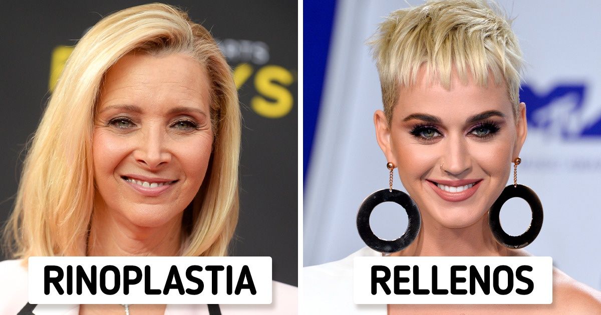 18 Famosas que revelaron orgullosamente que se sometieron a una cirugía estética y no se arrepintieron 18 Famosas que revelaron orgullosamente que se sometieron a una cirugía estética y no se arrepintieron