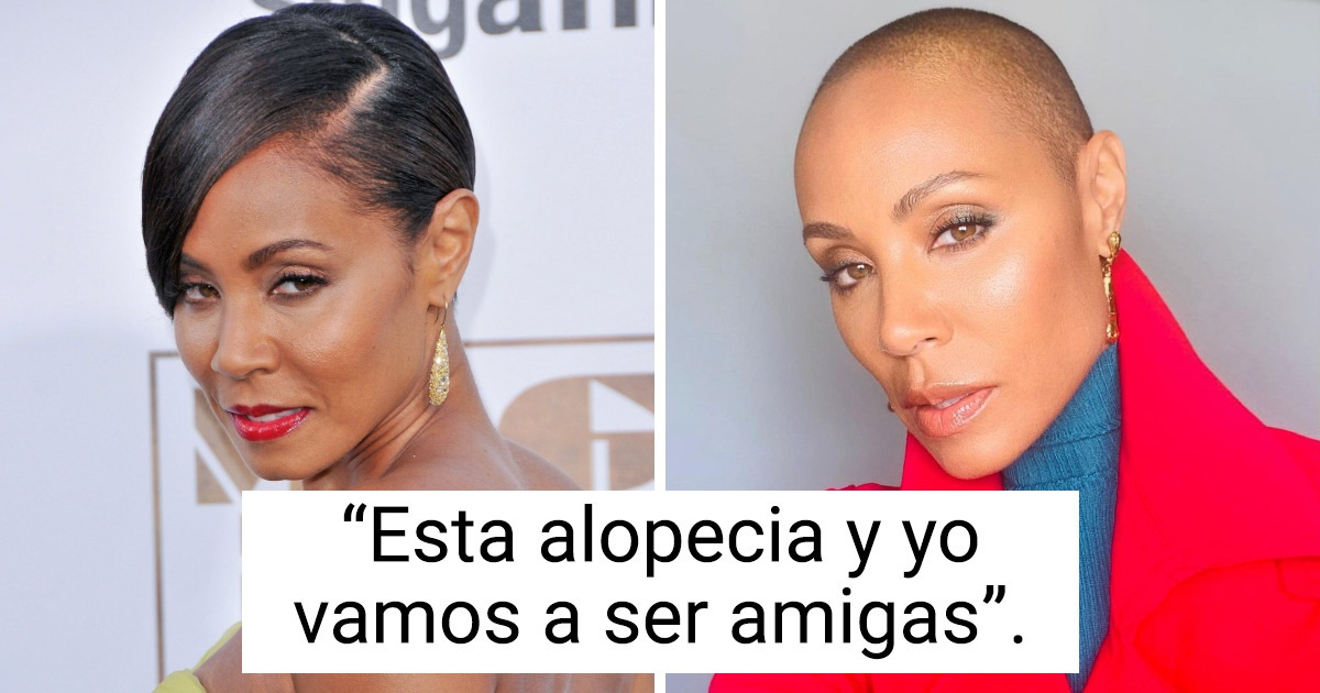 10 Mujeres famosas revelaron por qué se afeitaron la cabeza y no podríamos estar más orgullosos de ellas 10 Mujeres famosas revelaron por qué se afeitaron la cabeza y no podríamos estar más orgullosos de ellas