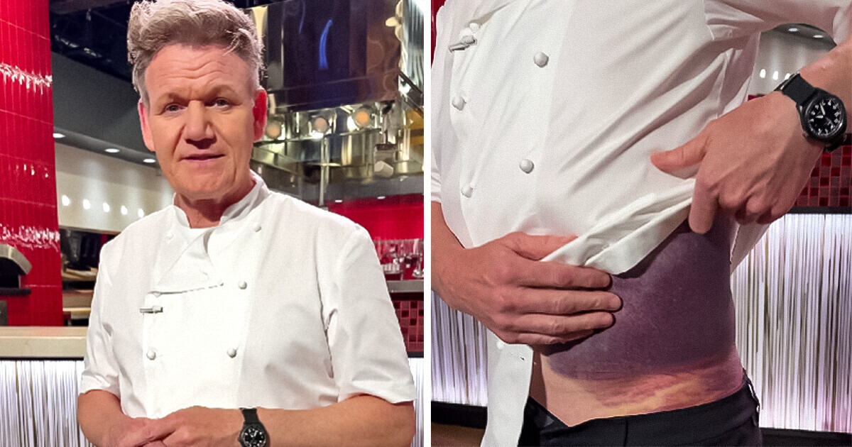 Gordon Ramsay sufrió un accidente que estuvo a punto de costarle la vida: "Tengo suerte de estar aquí" Gordon Ramsay sufrió un accidente que estuvo a punto de costarle la vida: "Tengo suerte de estar aquí"