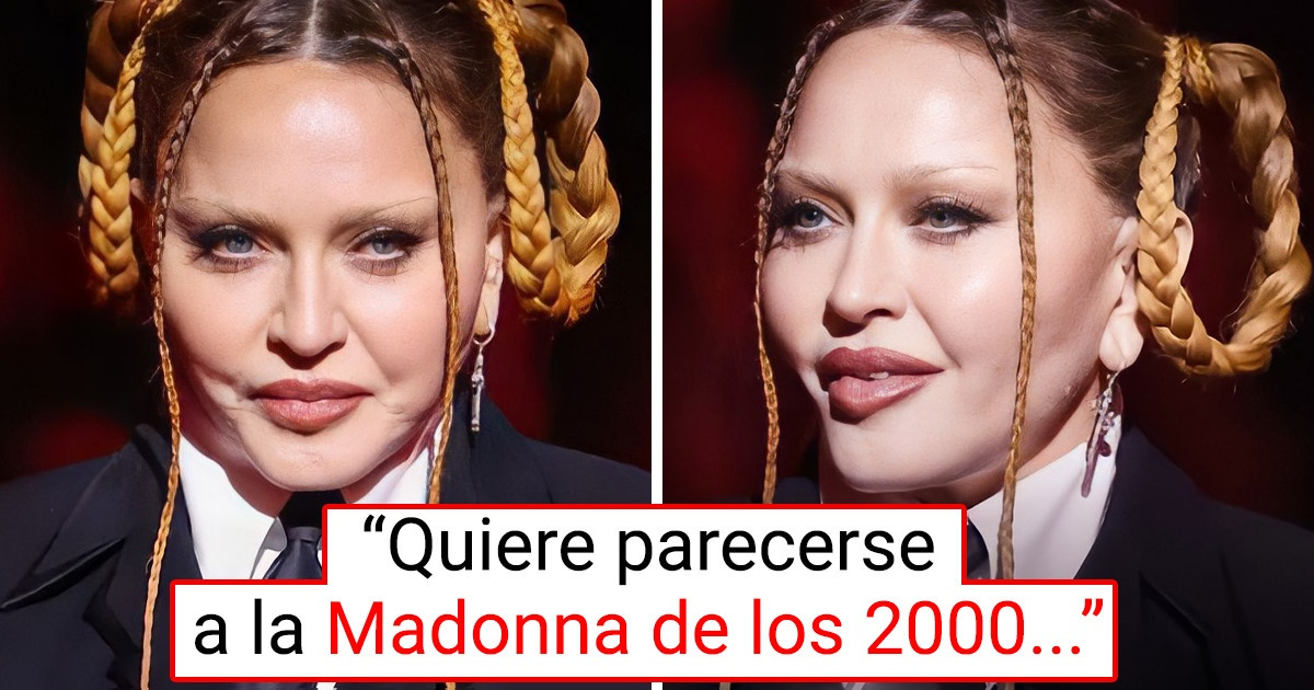 Una fuente cercana a Madonna reveló por qué está cambiando sus rasgos Una fuente cercana a Madonna reveló por qué está cambiando sus rasgos