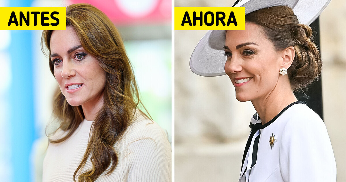 “¿Cómo es que aún lleva el cabello?”, la primera salida de la princesa Catherine conmociona a la gente en pleno tratamiento de quimioterapia “¿Cómo es que aún lleva el cabello?”, la primera salida de la princesa Catherine conmociona a la gente en pleno tratamiento de quimioterapia