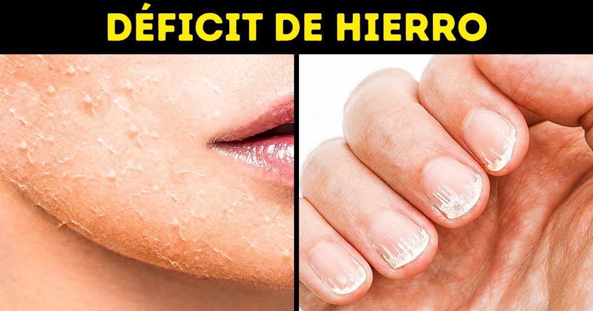 5 Elementos nutritivos que casi siempre nos hacen falta, y de dónde los podemos obtener