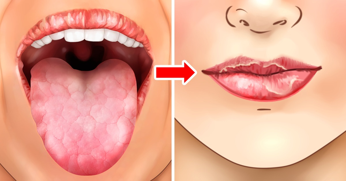 Por qué se resecan los labios (y algunos tips para evitarlo) Por qué se resecan los labios (y algunos tips para evitarlo)