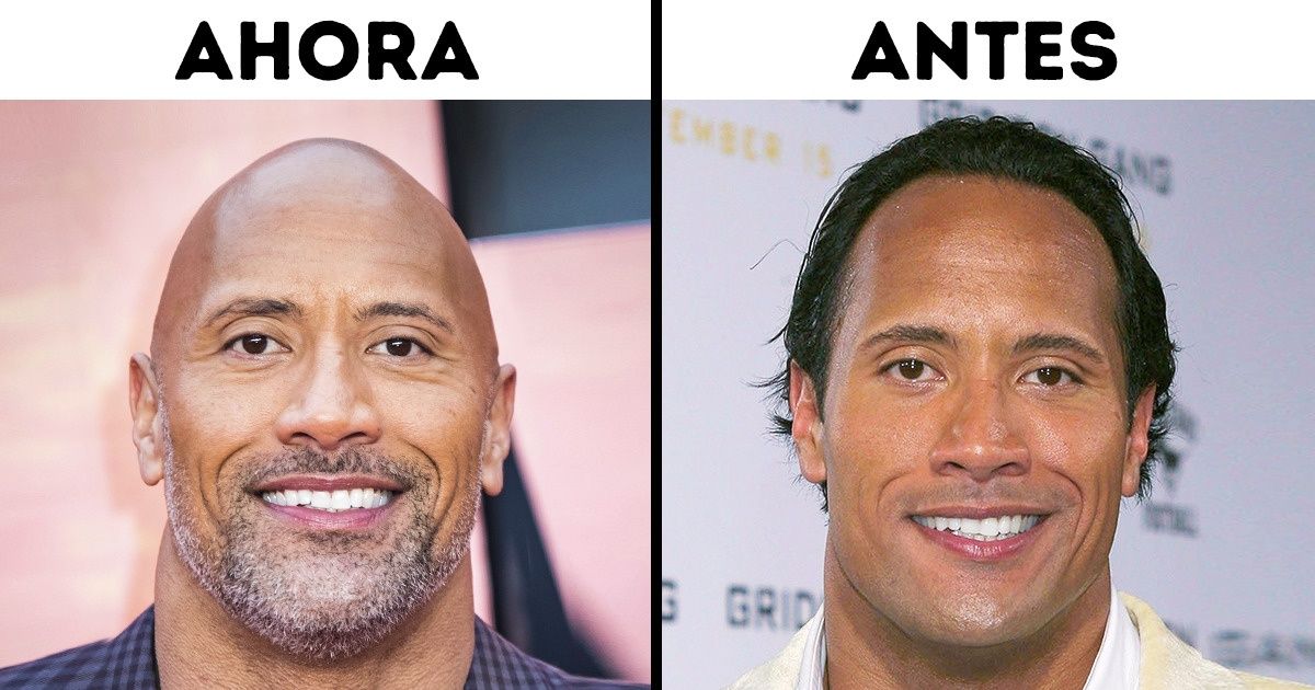 11 Celebridades antes de que la calvicie se convirtiera en parte integral de su imagen