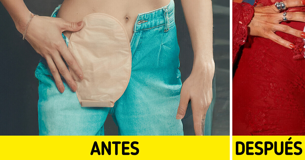 Una mujer transforma dispositivos médicos en accesorios de moda y deja a todos asombrados