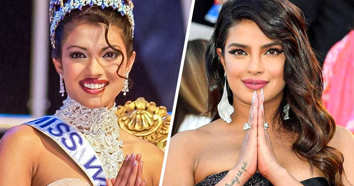 Cómo Priyanka Chopra logró ver la luz tras las tinieblas de una cirugía que modificó su rostro Cómo Priyanka Chopra logró ver la luz tras las tinieblas de una cirugía que modificó su rostro