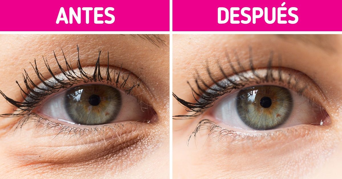 Por qué aparecen las ojeras y cómo deshacernos de ellas Por qué aparecen las ojeras y cómo deshacernos de ellas