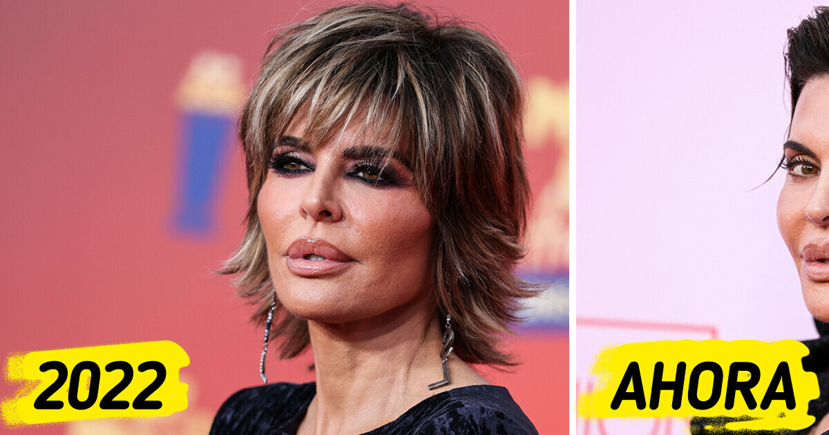 'Arruinó su rostro', la última aparición de Lisa Rinna conmociona a los fans 'Arruinó su rostro', la última aparición de Lisa Rinna conmociona a los fans