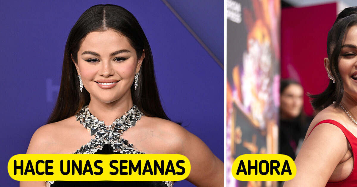 El nuevo look de Selena Gomez que no pasa desapercibido: ¿qué sucede con sus brazos? El nuevo look de Selena Gomez que no pasa desapercibido: ¿qué sucede con sus brazos?