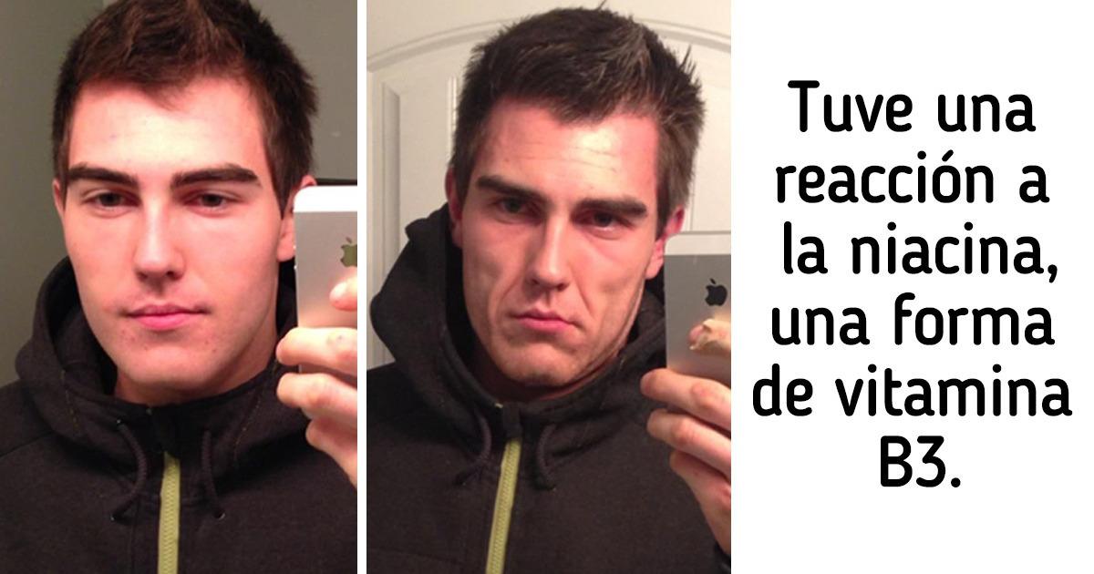14 Personas que fueron sorprendidas con cosas impredecibles que surgieron de la nada