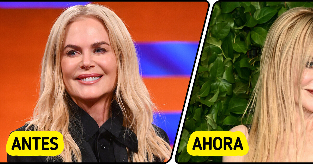 Nicole Kidman luce completamente diferente en su más reciente aparición Nicole Kidman luce completamente diferente en su más reciente aparición