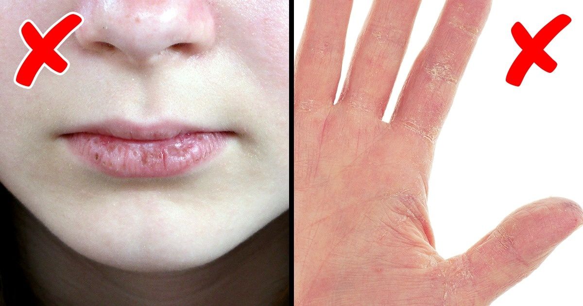 6 Señales del cuerpo de que estás envejeciendo demasiado rápido
