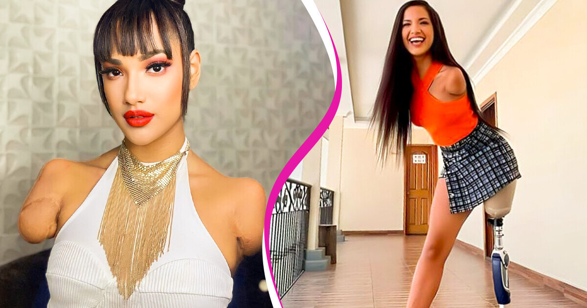 Perdió 3 extremidades siendo niña y hoy en día es una exitosa modelo Perdió 3 extremidades siendo niña y hoy en día es una exitosa modelo