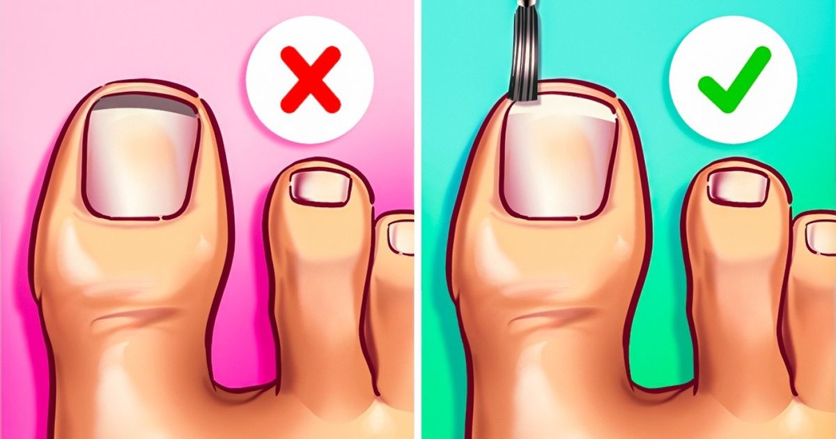 10 Remedios simples para curar el mal olor en los pies en poco tiempo