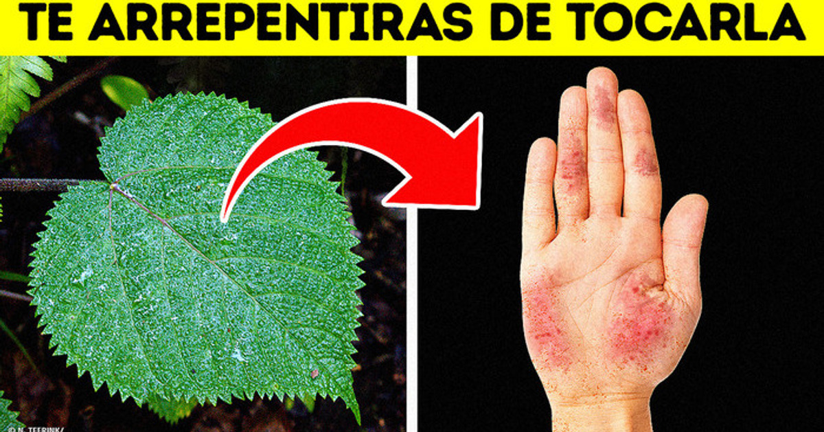 La planta despiadada cuya picadura dura años