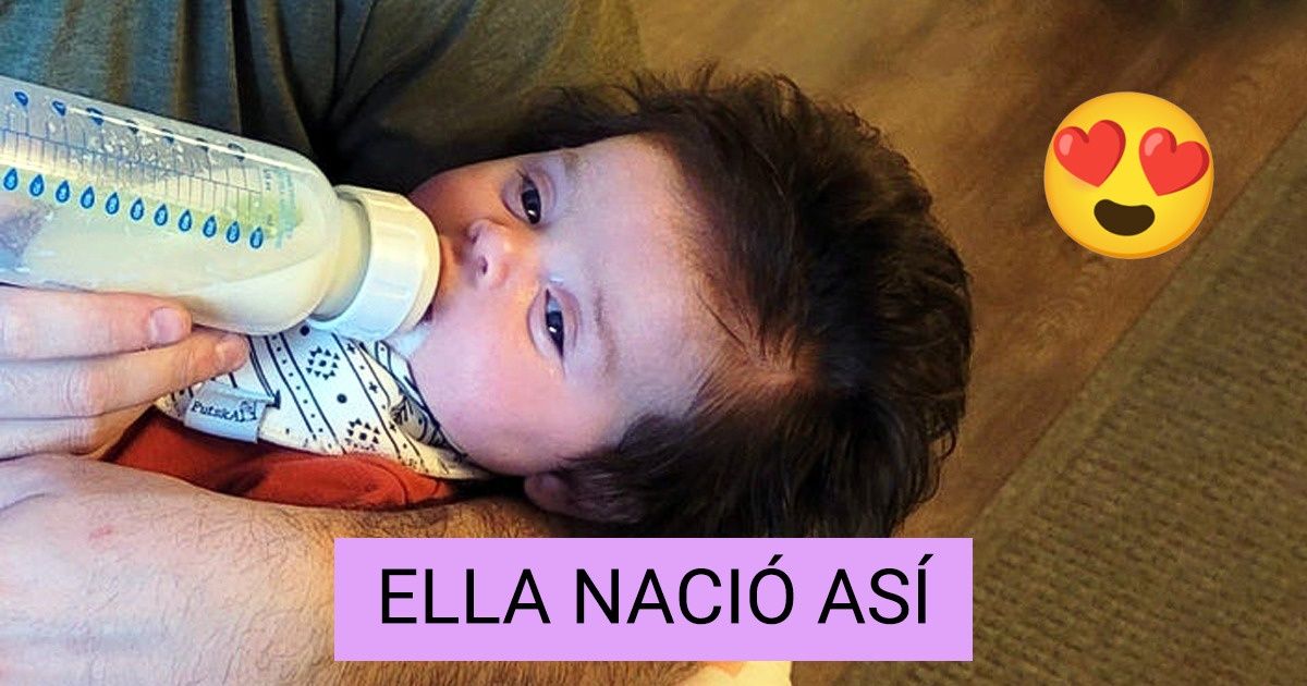 20+ Veces en que la naturaleza se puso creativa y creó seres con rasgos únicos (nueva selección)