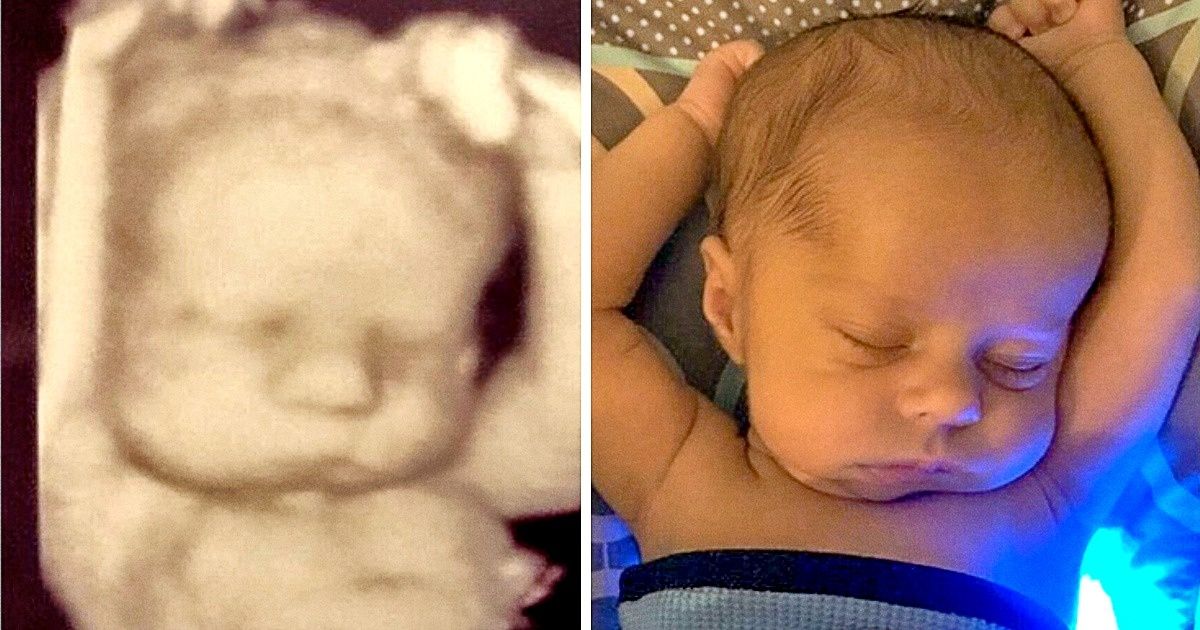 25 Fotos de “antes y después” que son difíciles de dejar de mirar