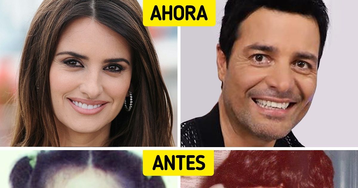 20 Imágenes de celebridades de cuando solían ser “patitos feos” en su juventud 20 Imágenes de celebridades de cuando solían ser “patitos feos” en su juventud