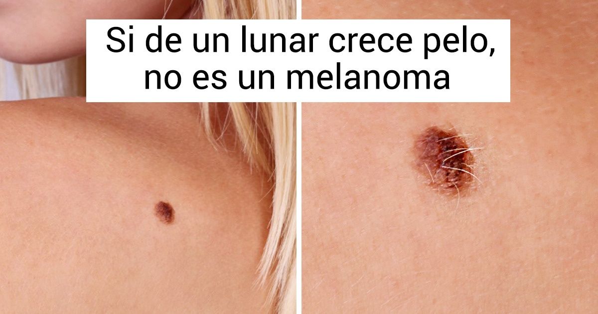 7 Buenas noticias para quienes temen con pánico padecer cáncer 7 Buenas noticias para quienes temen con pánico padecer cáncer