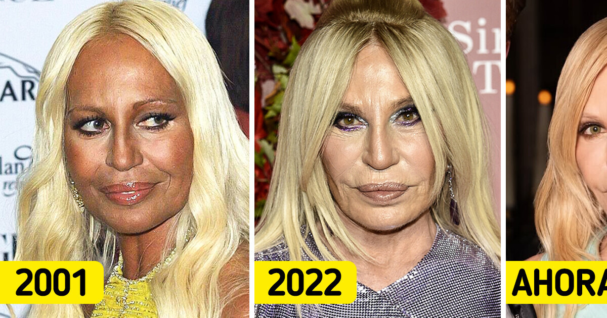 10 Iconos que desafiaron el tiempo y se transformaron de manera fascinante 10 Iconos que desafiaron el tiempo y se transformaron de manera fascinante