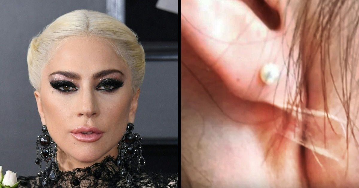 14 Procedimientos cosméticos inusuales, gracias a los cuales los famosos se ven muy elegantes 14 Procedimientos cosméticos inusuales, gracias a los cuales los famosos se ven muy elegantes