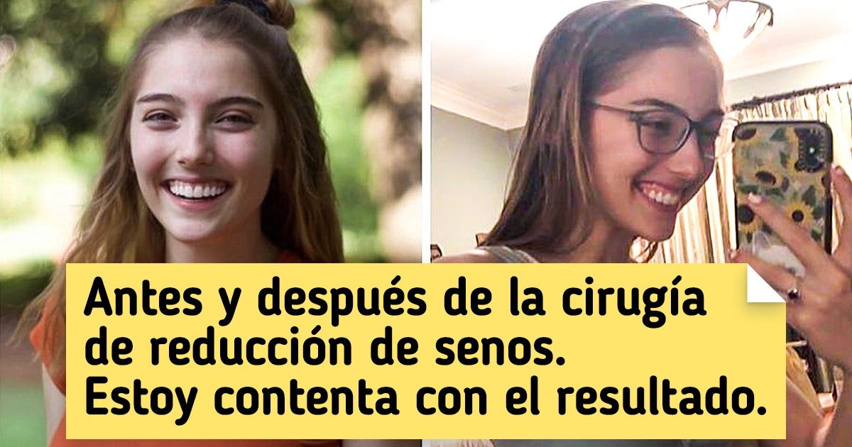 20+ Fotos de “antes y después” que muestran el progreso en su forma más pura 20+ Fotos de “antes y después” que muestran el progreso en su forma más pura