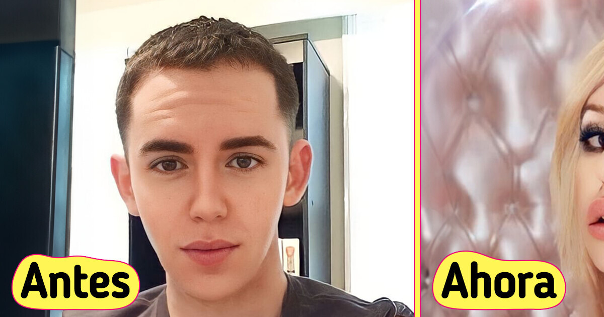 He invertido más de 100 000 USD en cirugía plástica para parecerme a Britney Spears He invertido más de 100 000 USD en cirugía plástica para parecerme a Britney Spears