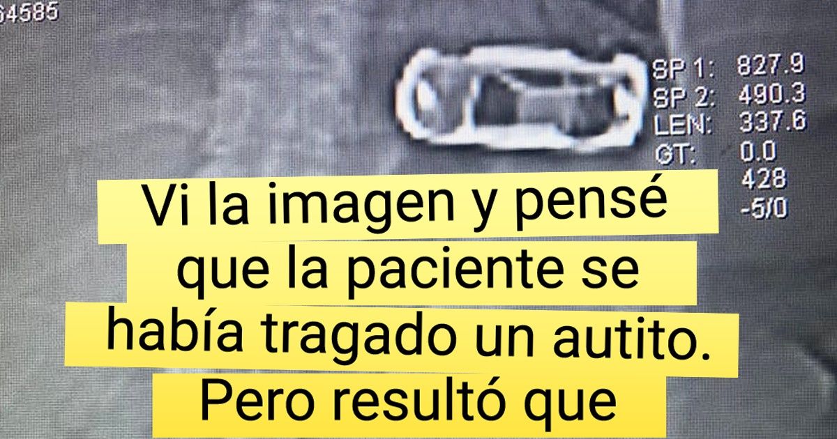 15+ Pruebas de que una imagen hecha por rayos X puede esconder muchas sorpresas