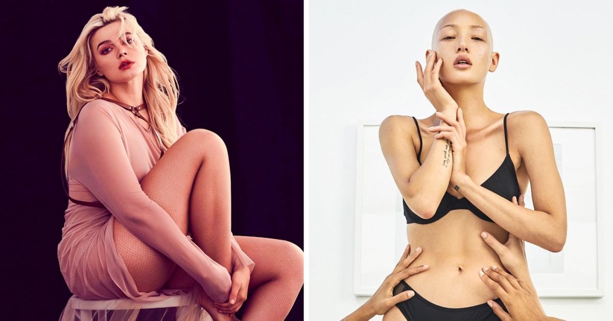 10 Modelos cuyo atrevimiento y belleza no estándar inspiran a millones de jóvenes con miedo a ser ellas mismas