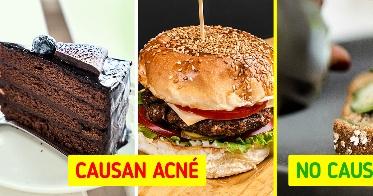 10+ Comidas que conviene consumir o evitar en una dieta antiacné 10+ Comidas que conviene consumir o evitar en una dieta antiacné