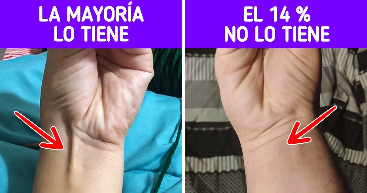 10+ Extraños rasgos físicos que vuelven a quien los posee la excepción de la regla 10+ Extraños rasgos físicos que vuelven a quien los posee la excepción de la regla