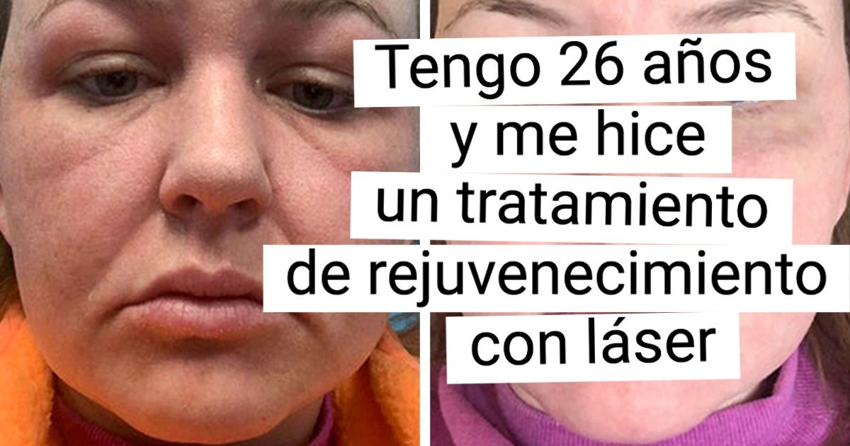 17 Chicas y chicos que decidieron realizar un cambio en su aspecto y ahora no pueden dejar de mirarse en el espejo