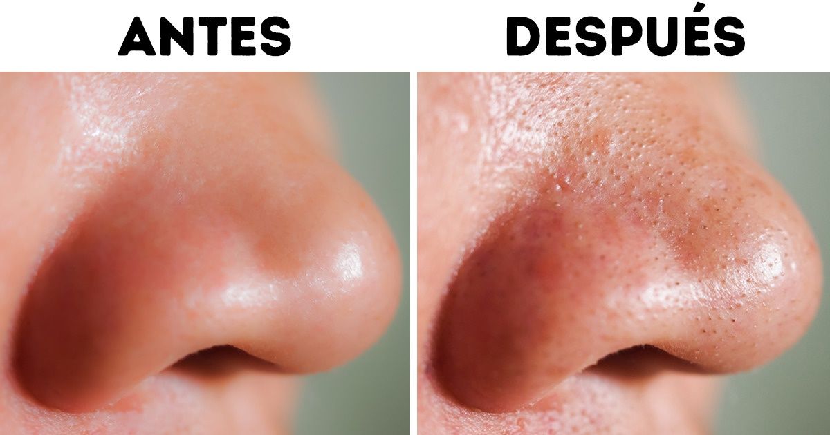 6 Cosas dañinas que las toallitas desmaquillantes pueden hacerle a tu piel 6 Cosas dañinas que las toallitas desmaquillantes pueden hacerle a tu piel