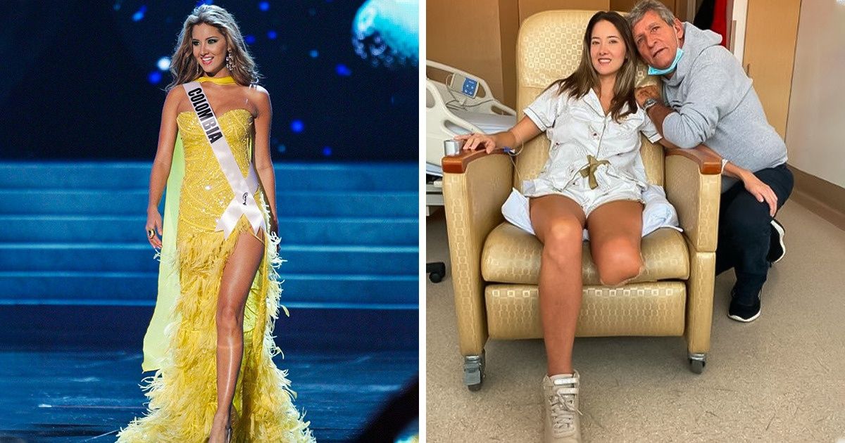 La ex Señorita Colombia nos inspira mientras comparte el amor por su cuerpo, a pesar de haber perdido una pierna La ex Señorita Colombia nos inspira mientras comparte el amor por su cuerpo, a pesar de haber perdido una pierna