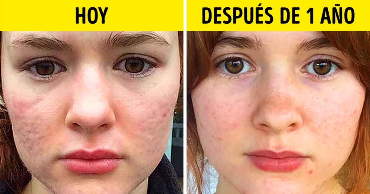 8 Componentes de cosméticos que realmente funcionan 8 Componentes de cosméticos que realmente funcionan