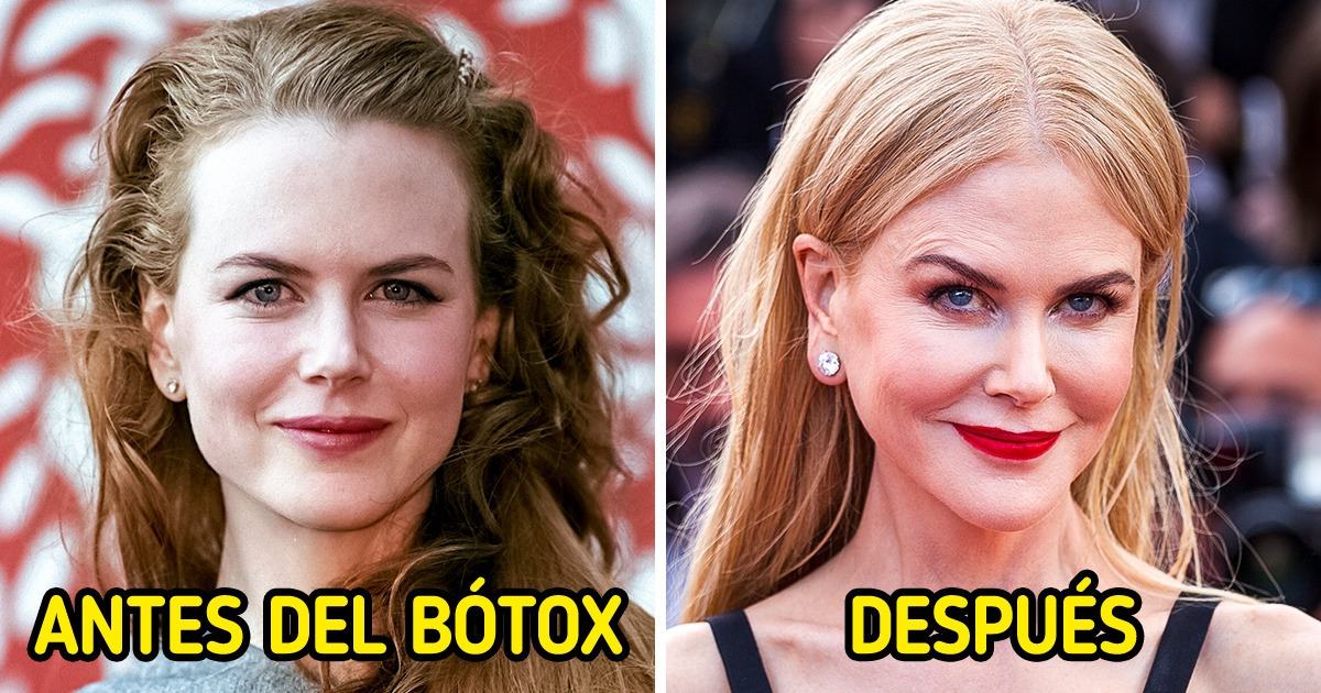 16 Famosos que se arrepintieron de sus procedimientos cosméticos 16 Famosos que se arrepintieron de sus procedimientos cosméticos