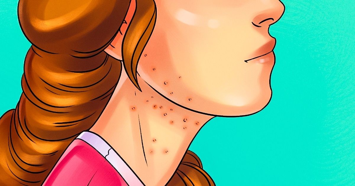 9 Señales que demuestran que estás comiendo demasiada azúcar 9 Señales que demuestran que estás comiendo demasiada azúcar
