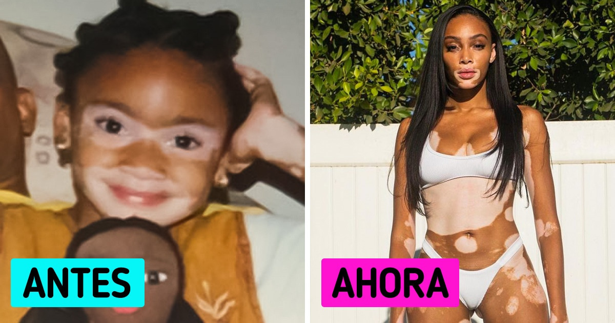 Winnie Harlow, la modelo que hace trizas los estereotipos de belleza
