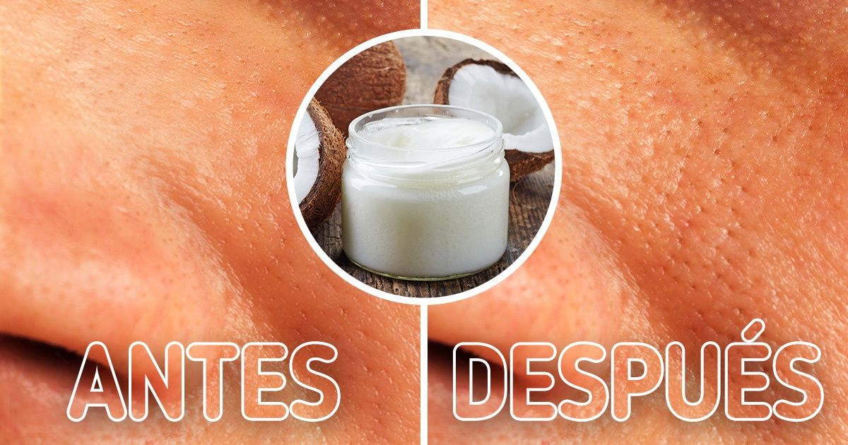 Dermatólogos comparten los peores consejos que han escuchado para el cuidado de la piel