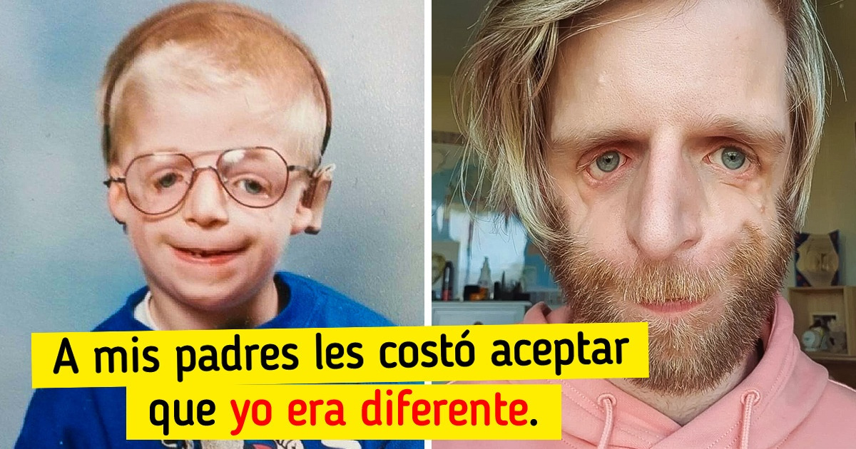 La historia de un británico que fue abandonado por su aspecto y se convirtió en un exitoso modelo y motivador