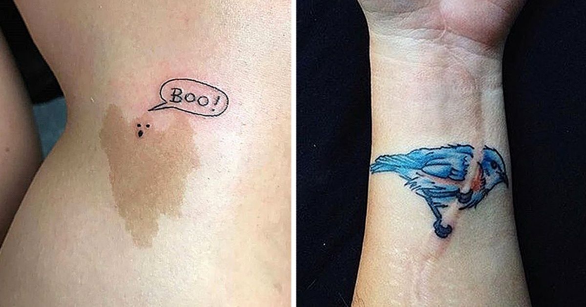 19 Personas que vencieron magistralmente los defectos de la piel con un tatuaje