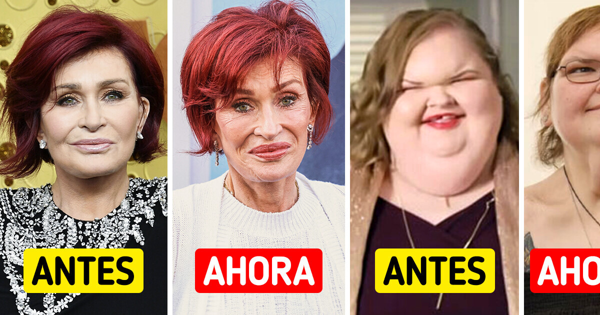 Impactantes transformaciones de celebridades que marcaron 2024