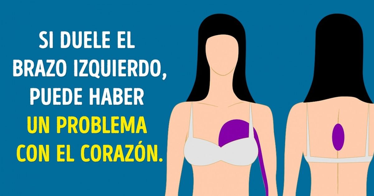 9 Tipos de dolor referido que pueden ser peligrosos si se ignoran