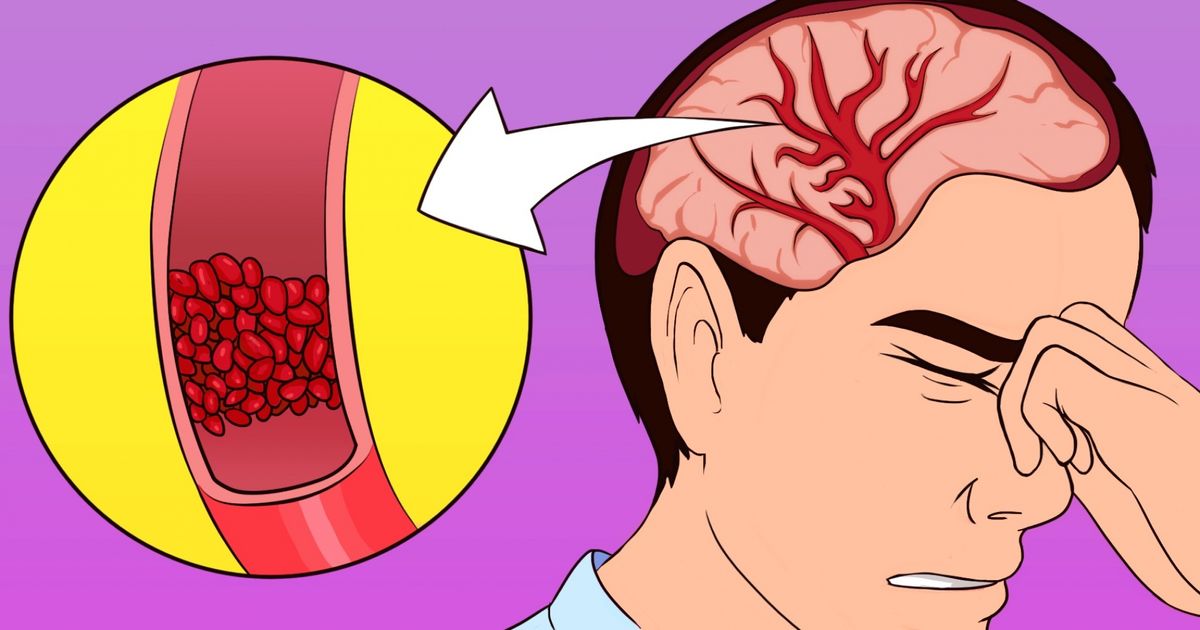 Si te duele la cabeza, estás agotado y tienes insomnio, empieza a consumir esto