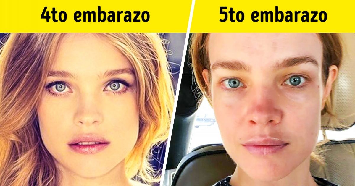 9 Extraños pero verídicos hechos sobre el embarazo que tu doctor no te cuenta
